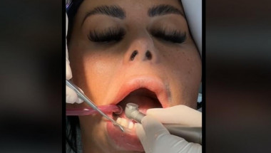 Ето как зъболекарят разбира, че сте правили орален секс