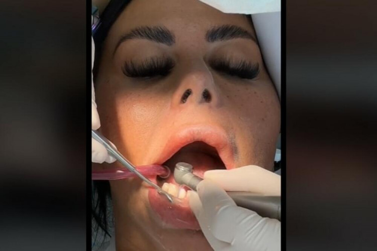 Ето как зъболекарят разбира, че сте правили орален секс