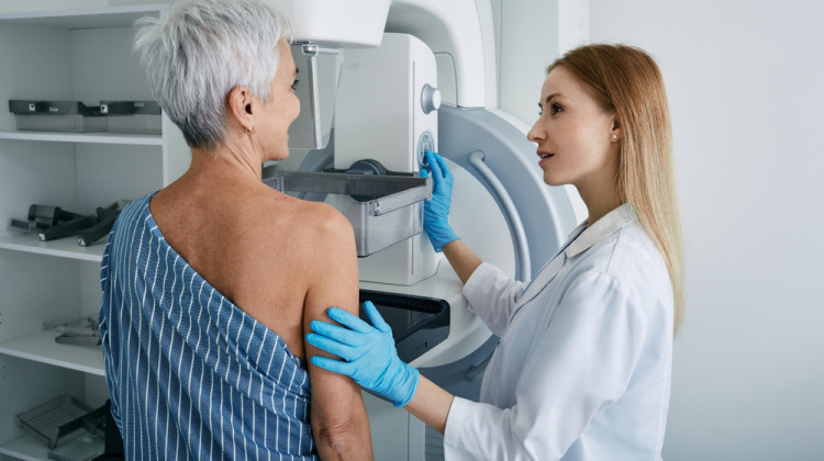 Полага ли ми се направление за мамолог и мамография, ако съм на 68 г.?