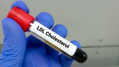 Ново лечение намалява лошия холестерол