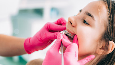 Д-р Гълъбица Спахиева: 90% от децата имат ортодонтски проблеми