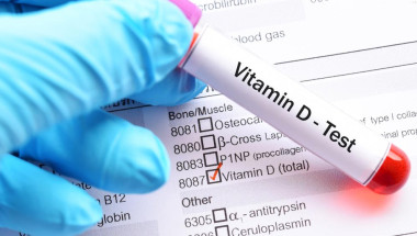 Изследването на витамин D покрива ли се от НЗОК?