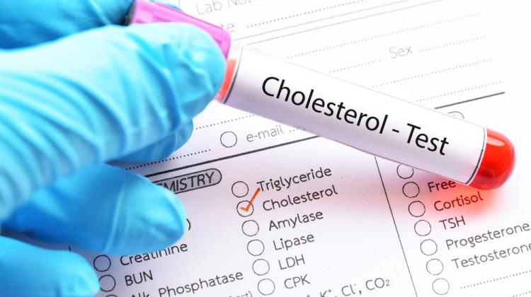 Препоръки на народната медицина при повишен холестерол