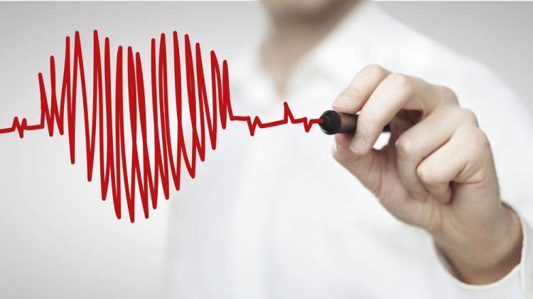Омега-3 – причина за опасни нарушения на сърдечния ритъм?