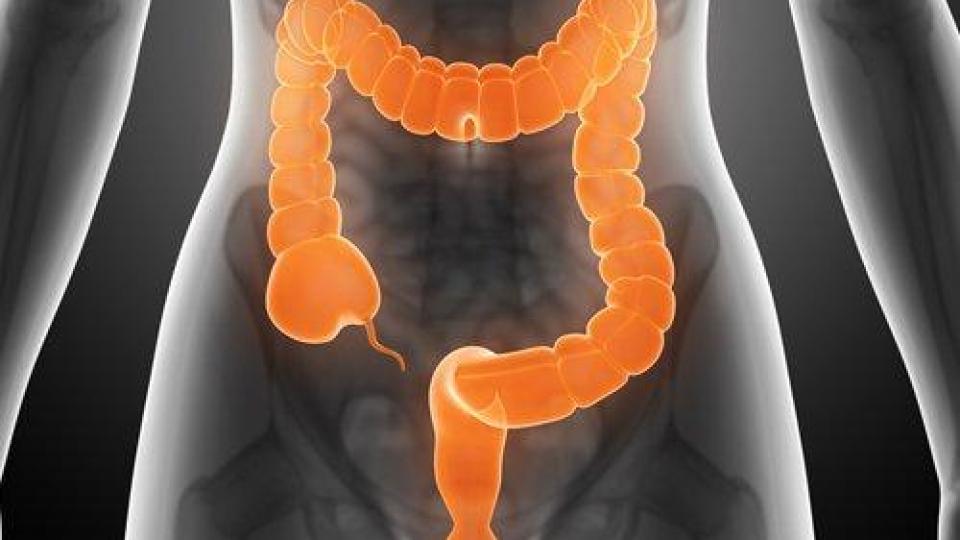 Имате ли синдром на раздразненото черво и как да го лекувате?