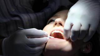 Рак на зъбите: Какво е това и можем ли да се справим с него?