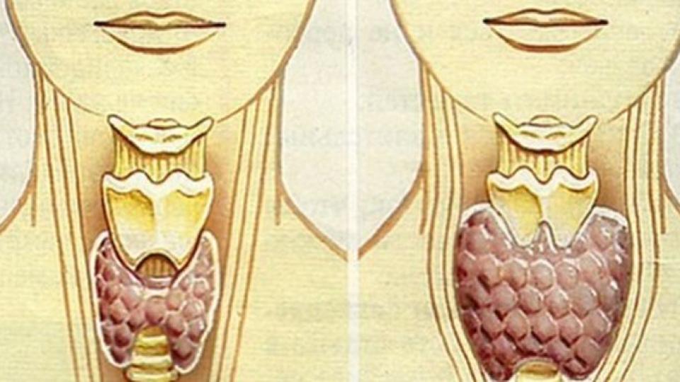 Този вълшебен лек ще излекува щитовидната ви жлеза само за 2 месеца