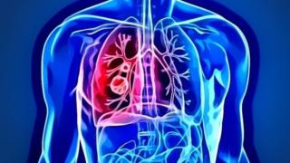 Колко живеят хората с диагноза рак на белия дроб?
