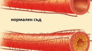 Само 50 мл. на ден от тази мощна напитка почиства артериите и предотвратява сърдечен удар!