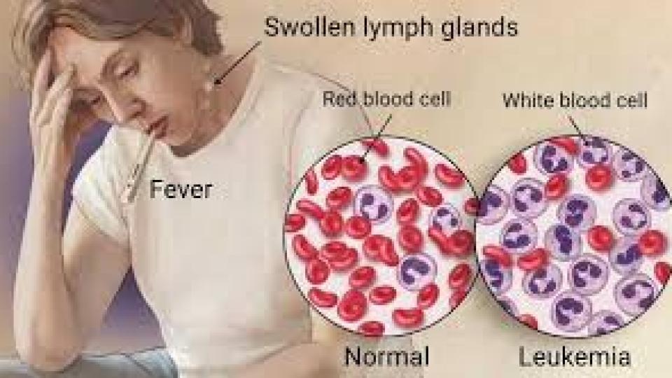 Характерни симптоми на левкемията