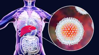 15% от заразените с хепатит С се възстановяват сами