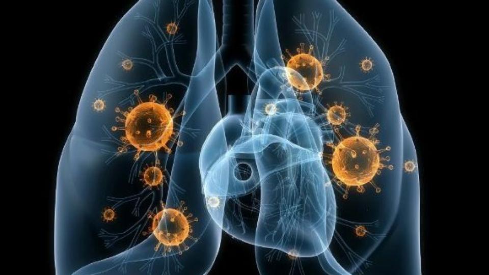 Как се лекува вирусна пневмония със забравени средства