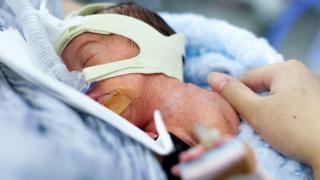 Пандемичните мерки са фатални за недоносените бебета