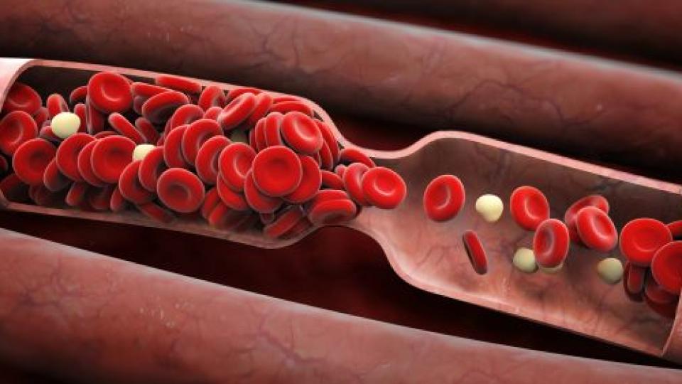 Тези плодове помагат да се отървете от кръвни съсиреци