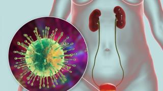 Съвети за бързо отърваване от цистит
