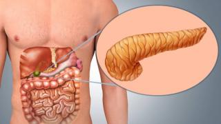 Онкологът Серяков изброи ранните симптоми на рак на панкреаса