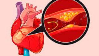 Ранни признаци на коронарна болест на сърцето