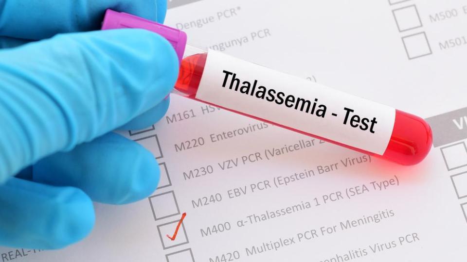 Д-р Мирела Рангелова: Само в България няма превенция на таласемия майор