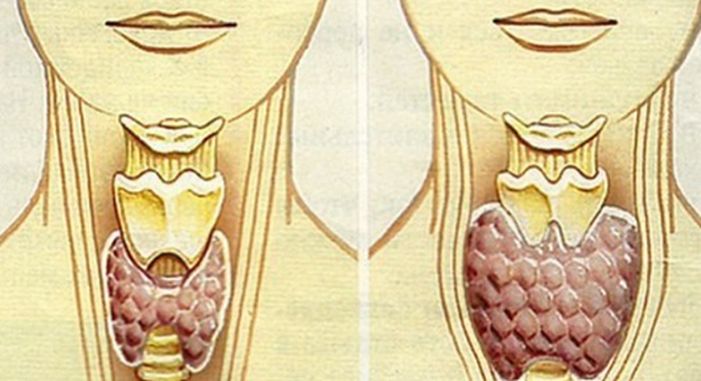 Този вълшебен лек ще излекува щитовидната ви жлеза само за 2 месеца