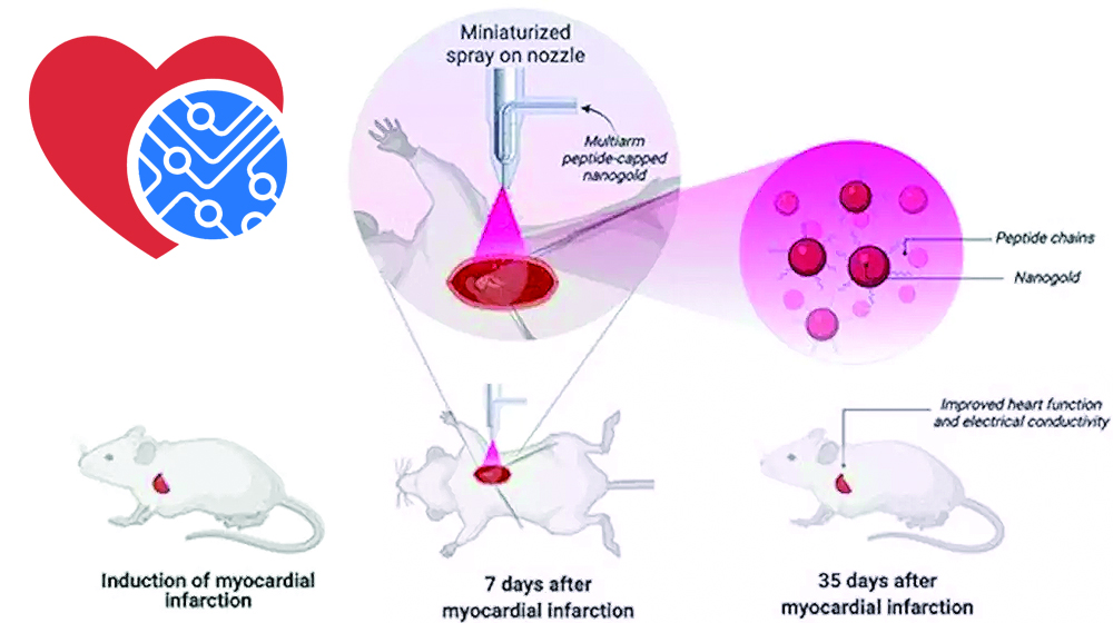 Технология със златни наночастици подпомага лечението на сърцето