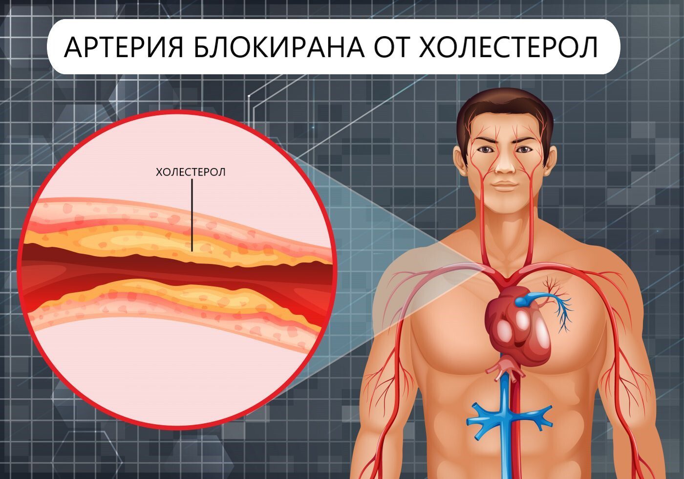 Oчите издават високия холестерол