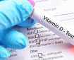 Изследването на витамин D покрива ли се от НЗОК?