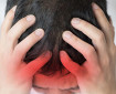 Внезапното силно главоболие - симптом на мозъчен удар